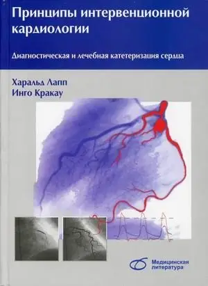 Принципы интервенционной кардиологии. Диагностическая и лечебная катетеризация сердца. Руководство фото книги