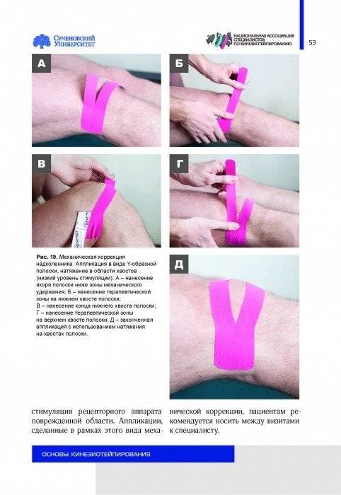 Основы кинезиотейпирования фото книги 7