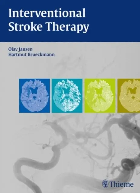 Interventional Stroke Therapy фото книги
