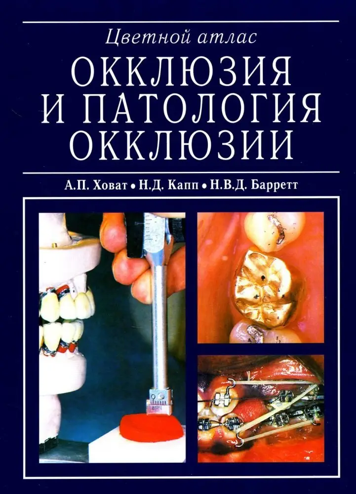 Окклюзия и патология окклюзии. Цветной атлас фото книги