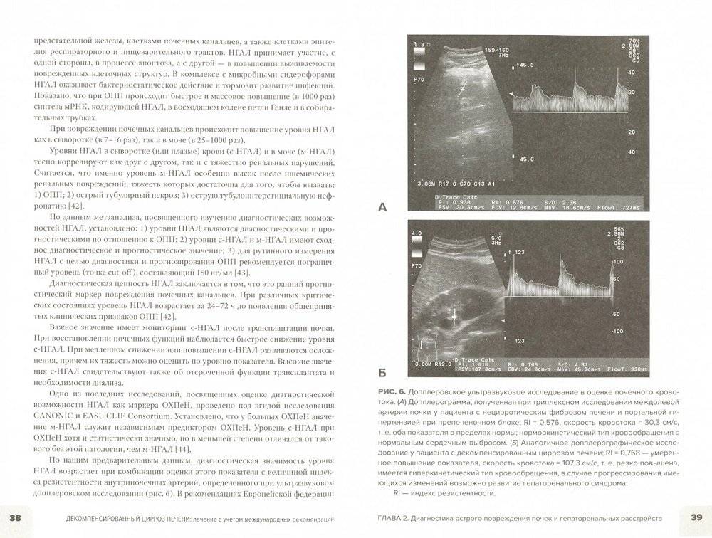 Декомпенсированный цирроз печени. Лечение с учетом международных рекомендаций фото книги 2