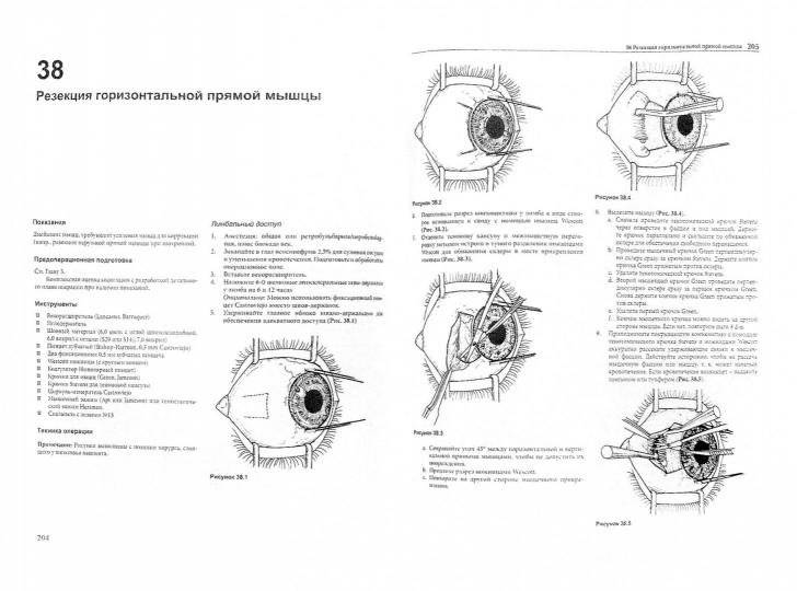 Офтальмохирургия фото книги 2