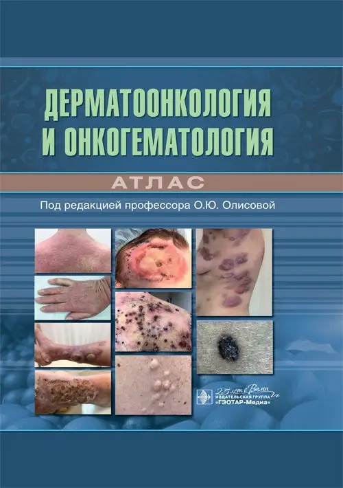 Дерматоонкология и онкогематология. Атлас фото книги