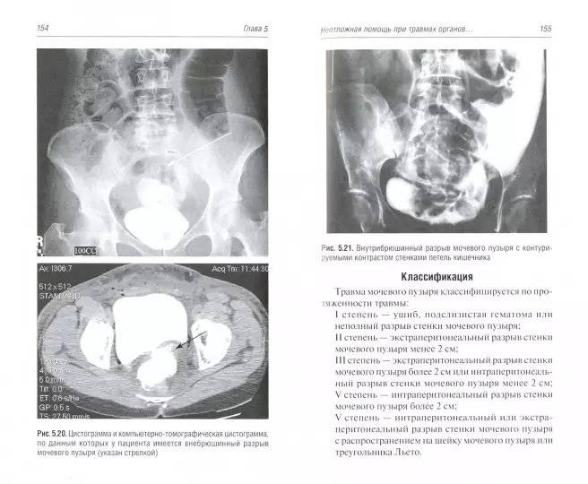 Неотложные состояния в урологии фото книги 2