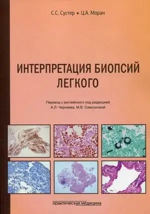 Интерпретация биопсий легкого фото книги