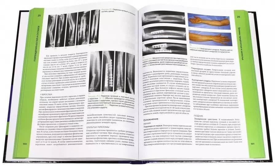 Ортопедия и травматология по Эпли. Руководство. В 3-х частях. Часть 3: Повреждения костей и суставов фото книги 2