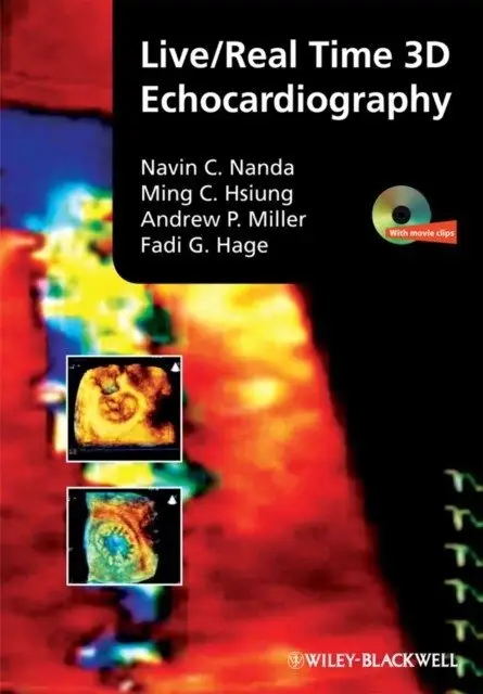 Live/real time 3d echocardiography фото книги
