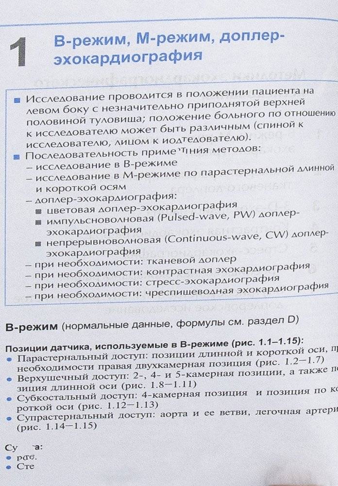 Справочник по эхокардиографии фото книги 3