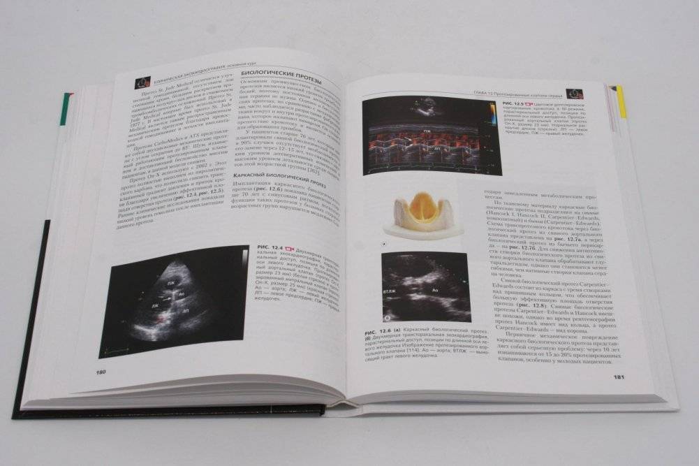 Клиническая эхокардиография: основной курс фото книги 2