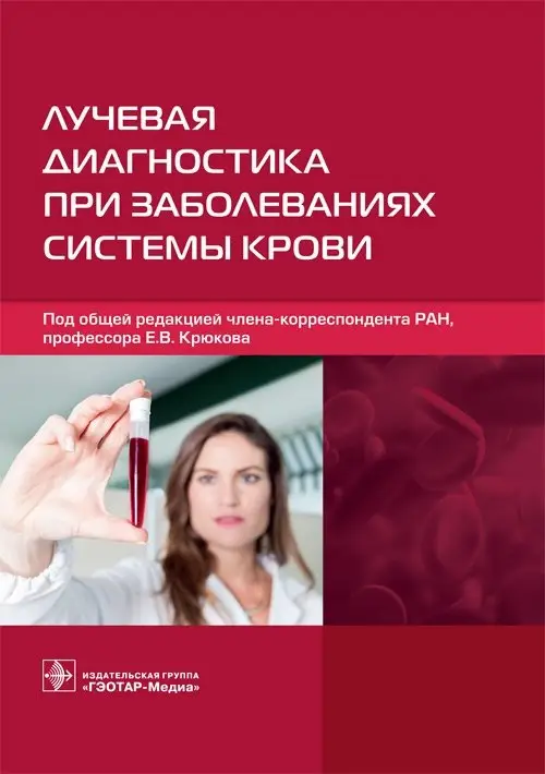 Лучевая диагностика при заболеваниях системы крови фото книги