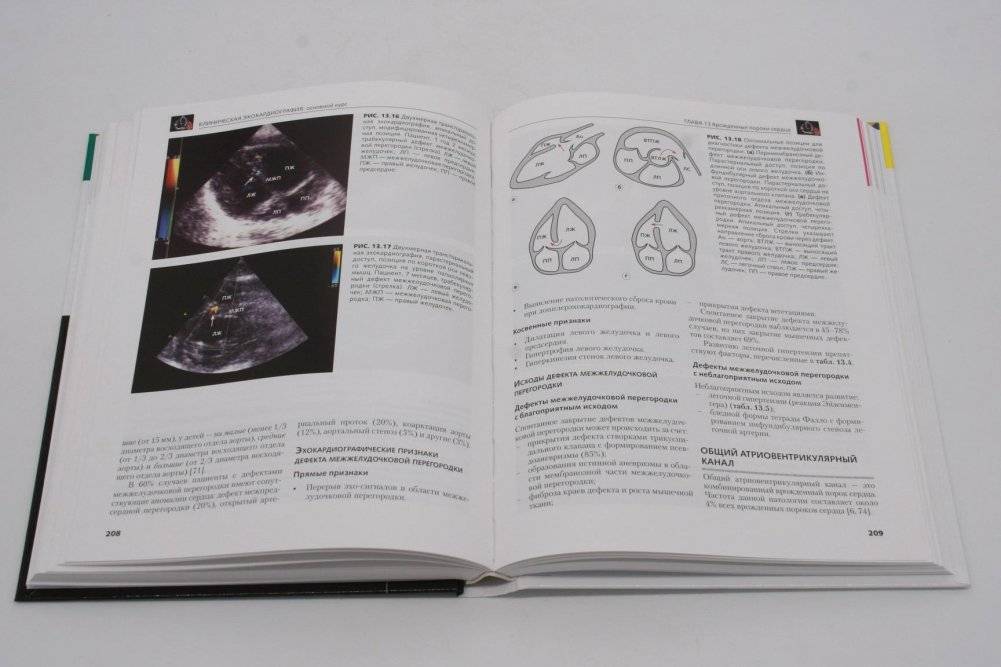 Клиническая эхокардиография: основной курс фото книги 3