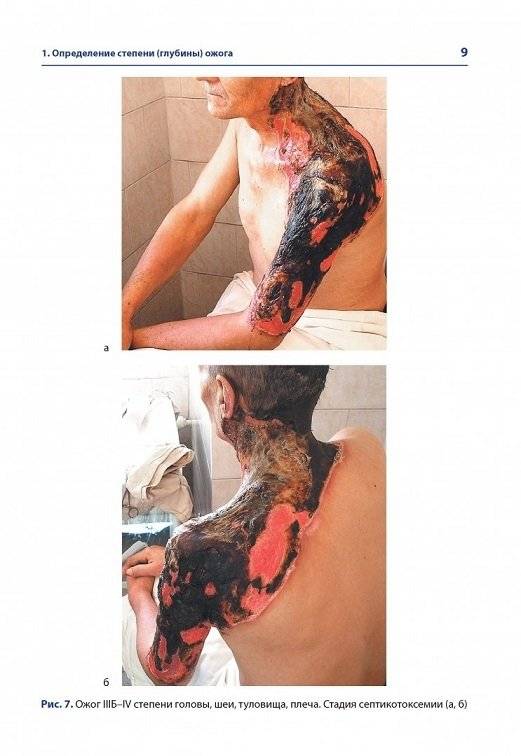 Атлас термических поражений фото книги 6