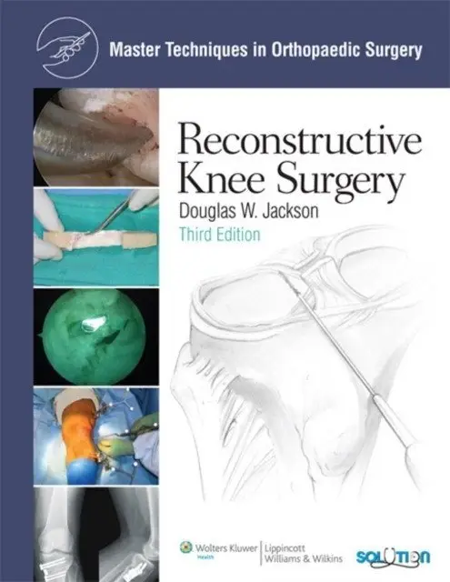 Mtos: recon knee surgery 3e cb фото книги