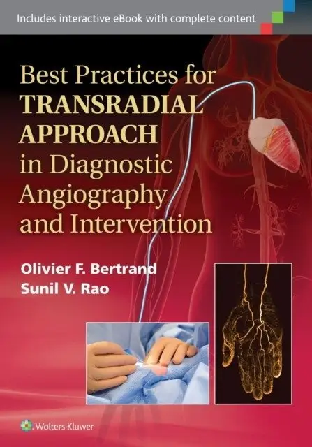 Best Practices for Transradial Approach in Diagnostic Angiography and Intervention фото книги