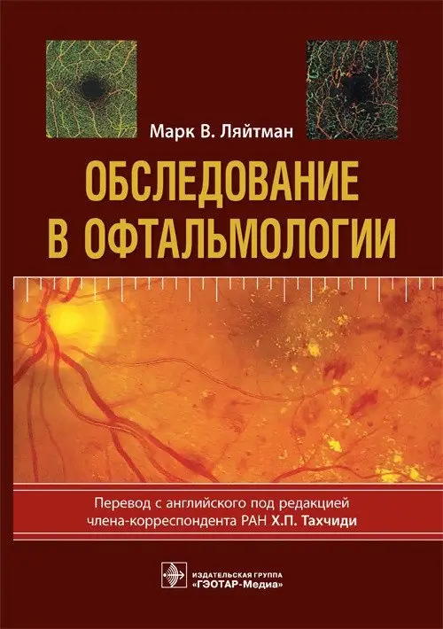 Обследование в офтальмологии фото книги