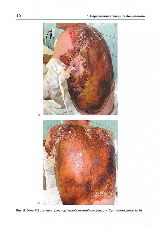 Атлас термических поражений фото книги 7