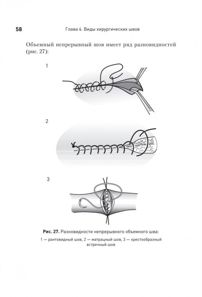 Хирургический шов. 3-е издание, обновленное фото книги 14