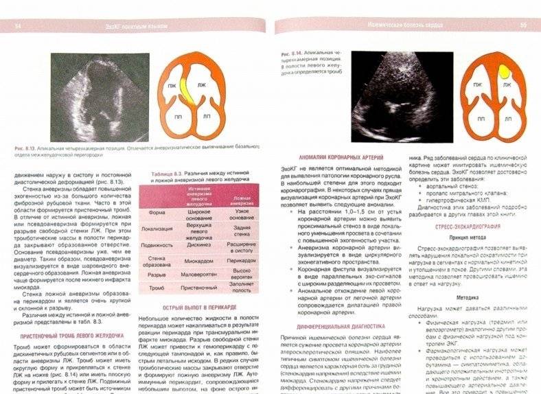 ЭхоКГ понятным языком фото книги 2