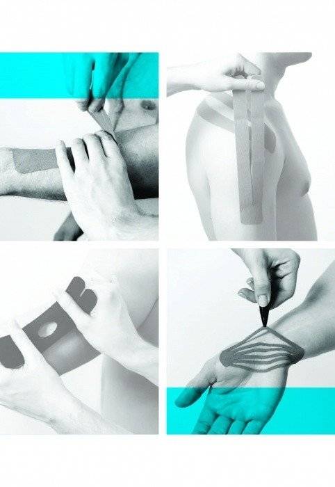 Основы кинезиотейпирования фото книги 5