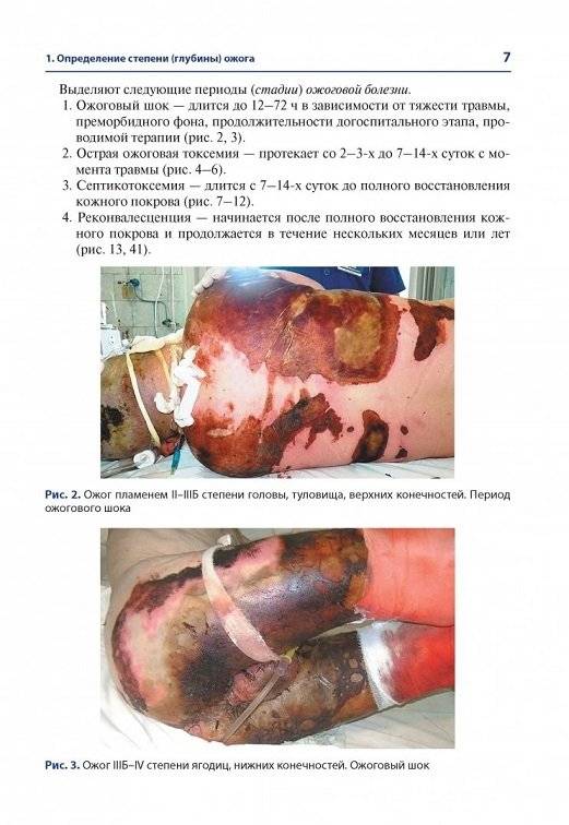 Атлас термических поражений фото книги 4