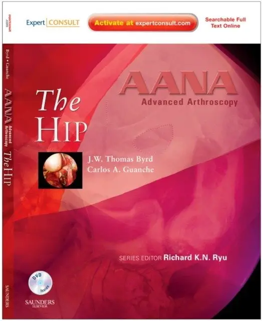 AANA Advanced Arthroscopy: The Hip фото книги