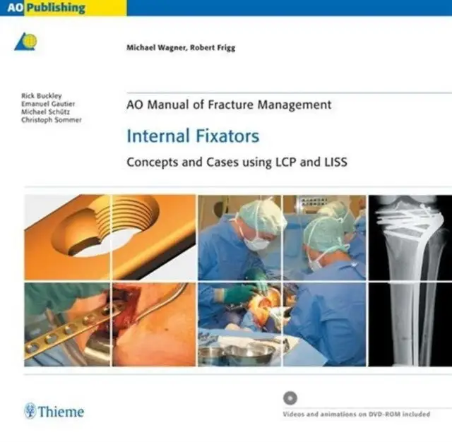 AO Manual of Fracture Management: Internal Fixators - Concepts and Cases using LCP/LISS фото книги