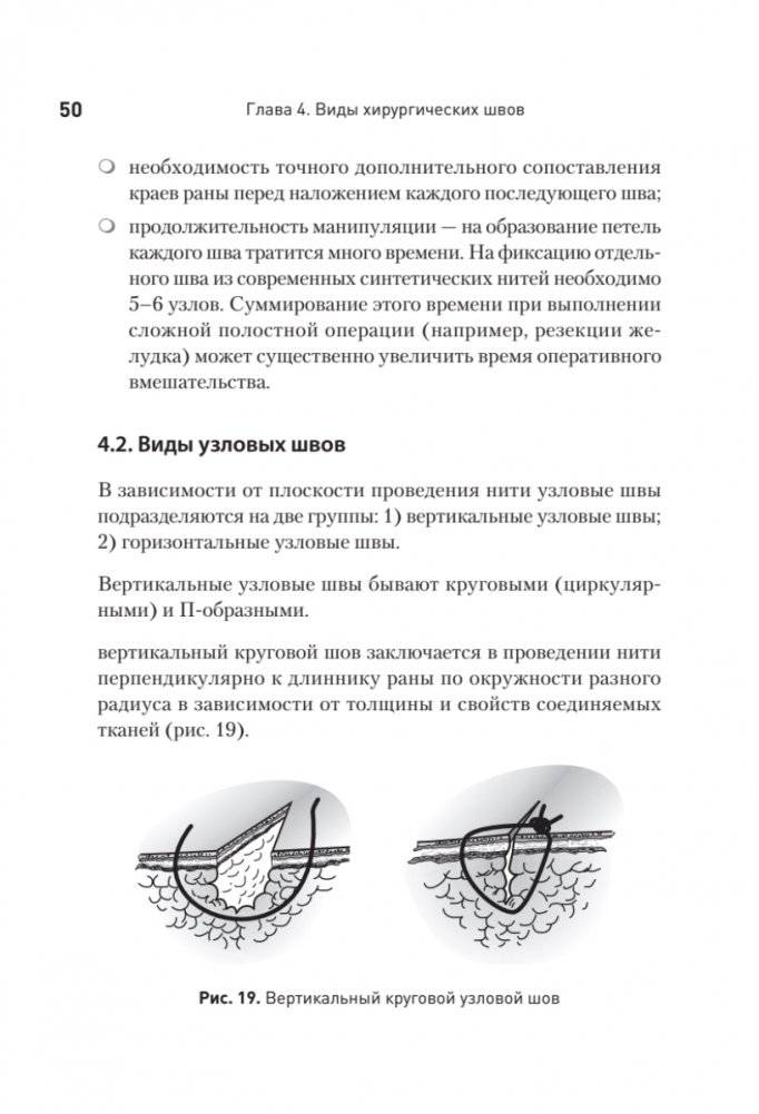 Хирургический шов. 3-е издание, обновленное фото книги 6
