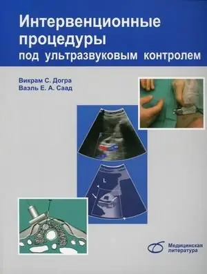 Интервенционные процедуры под ультразвуковым контролем. Руководство фото книги