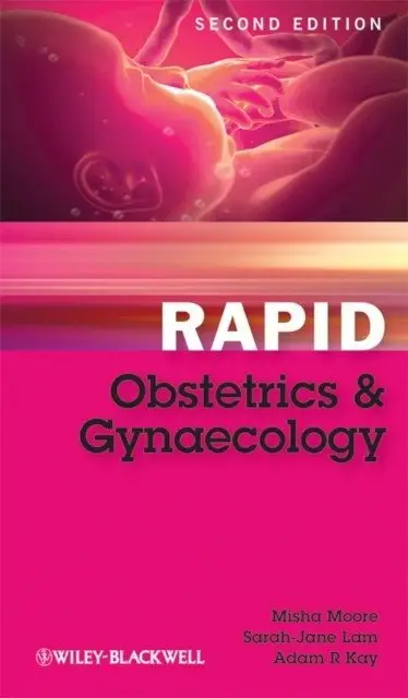 Rapid obstetrics and gynaecology фото книги