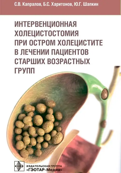 Интервенционная холецистомия при остром холецистите в лечении пациентов старших возрастных групп фото книги