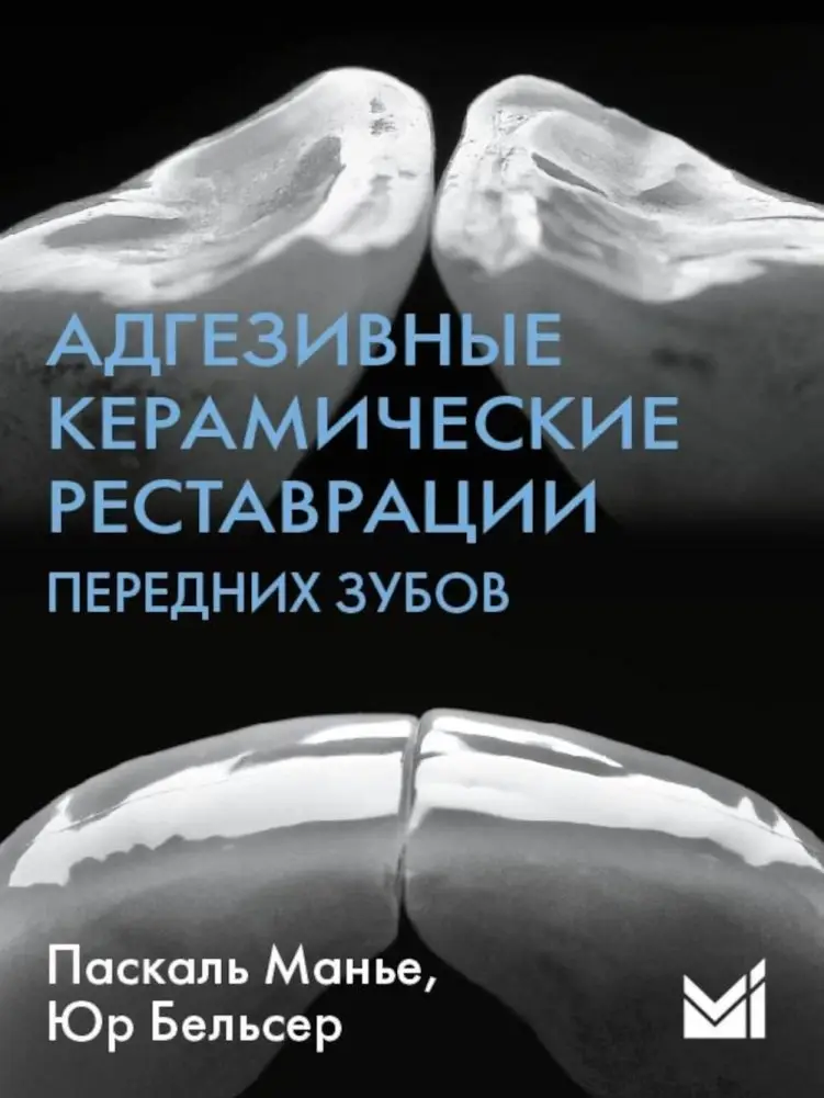 Адгезивные керамические реставрации передних зубов. 4-е издание фото книги