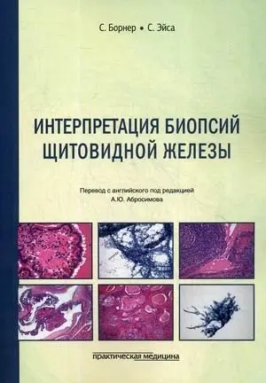 Интерпретация биопсий щитовидной железы фото книги