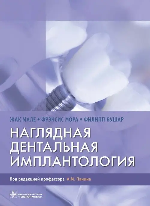 Наглядная дентальная имплантология фото книги