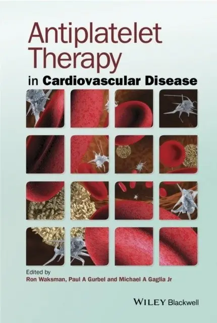 Antiplatelet Therapy фото книги