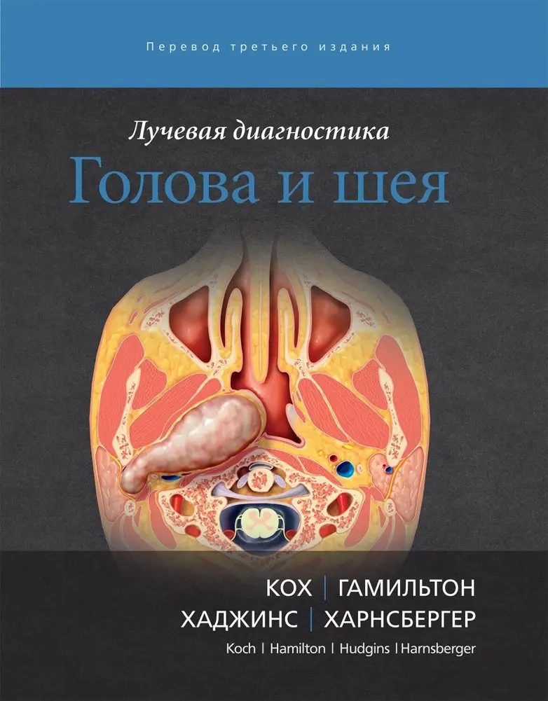 Лучевая диагностика. Голова и шея фото книги
