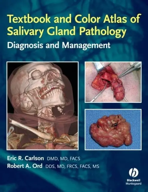 Textbook and Color Atlas of Salivary Gland Pathology фото книги