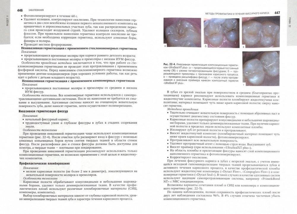 Детская терапевтическая стоматология. Национальное руководство фото книги 2