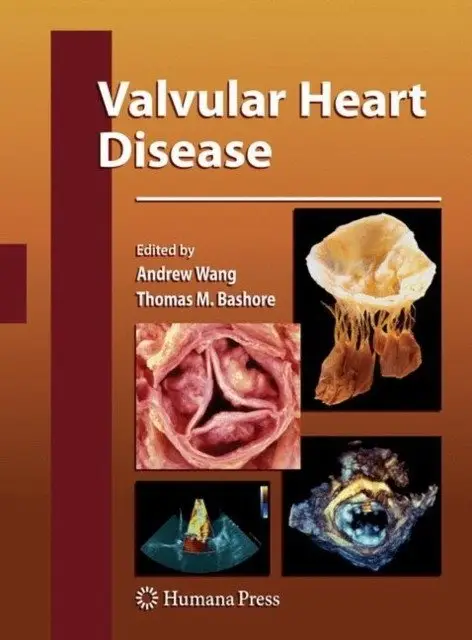 Valvular Heart Disease фото книги