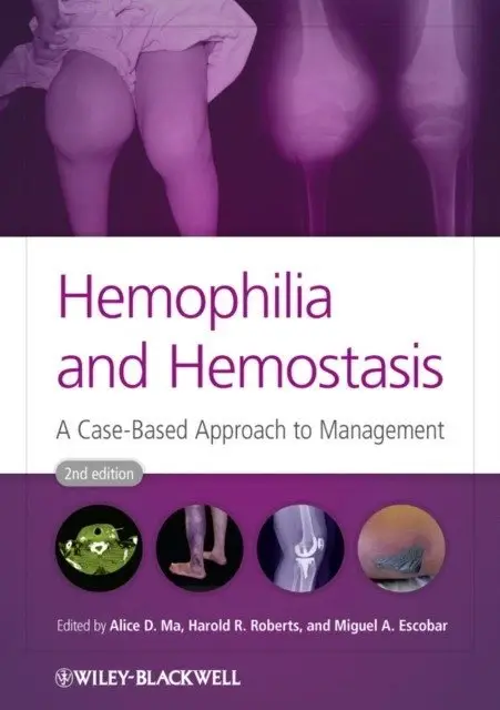 Hemophilia and Hemostasis: A Case-Based Approach to Management, 2nd Edition фото книги