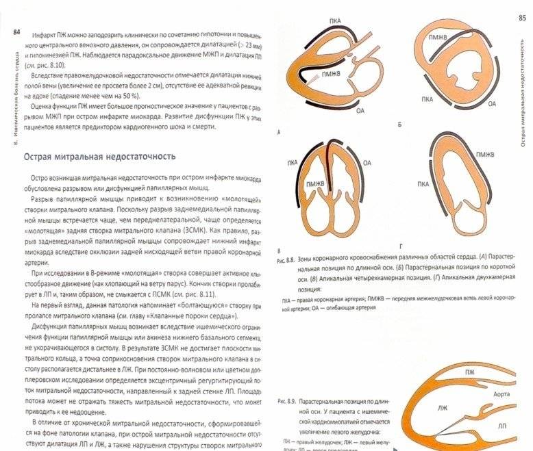ЭхоКГ понятным языком фото книги 3