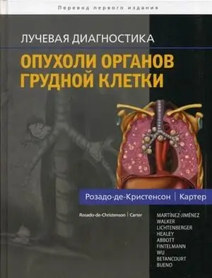 Лучевая диагностика. Опухоли органов грудной клетки фото книги