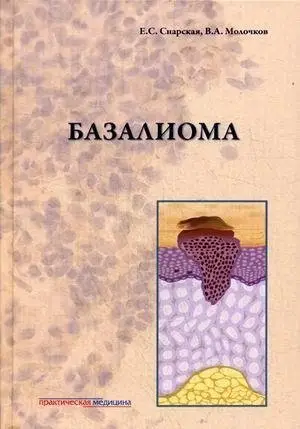 Базалиома фото книги