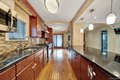 Additional image 11 of 188-14 McLaughlin Ave, Hollis, NY, 11423