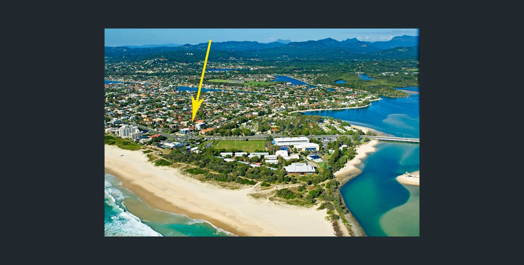 Additional image 5 of 1/6 Nyrang Ave, Palm Beach QLD 4221