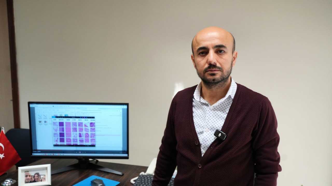 Karabük Üniversitesi kolon kanserinde tanıyı hızlandıracak yapay zeka sistemi geliştiriyor
