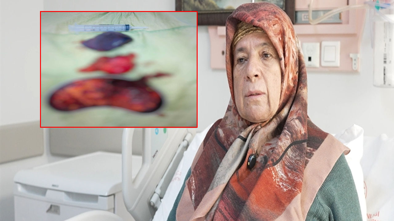 Aylarca karnında taşımış! Dev tümöre kendisi bile inanamadı! 