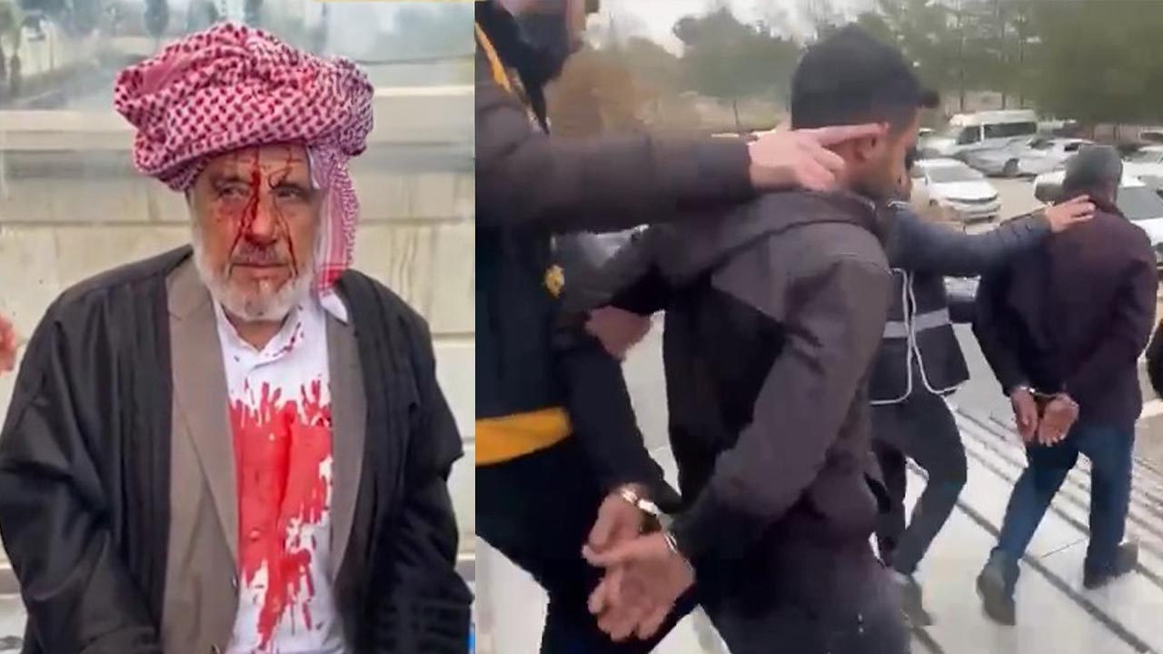 Şanlıurfa'da yaşlı adama taşlı sopalı saldırı! 