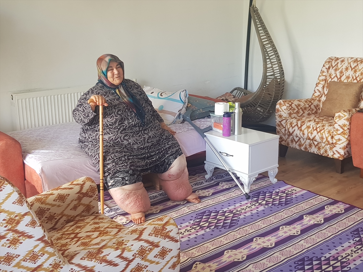Fil Hastası Emine Teyze'nin Hayatına Tekerlekli Sandalye Umudu