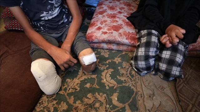 Gazze ampute çocuk sayısı, nüfusa oranla dünyada en yüksek