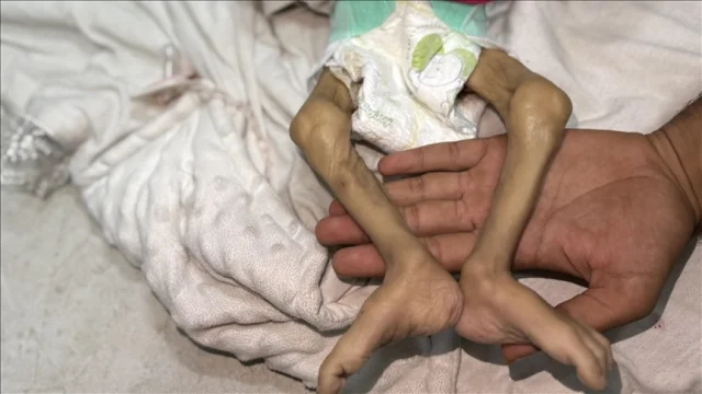 WFP: Nijerya'da 2026'da 35 milyon kişi açlıkla karşılaşacak